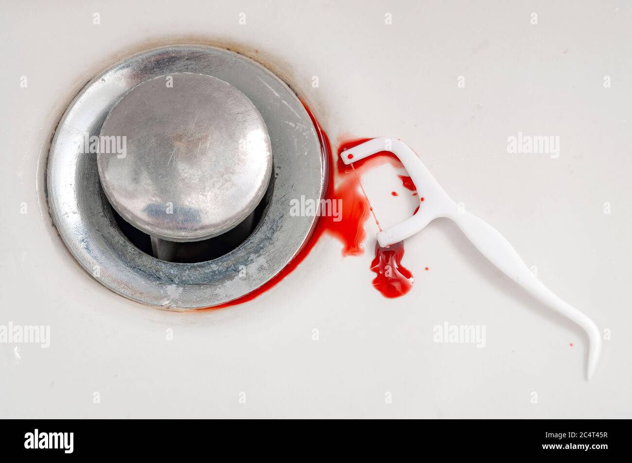 Saignements de gencives lors de la soie dentaire et de la gingivite concept thème avec gros plan sur un fil dentaire de prélèvement recouvert de sang et dopé dans un lavabo de salle de bains Banque D'Images