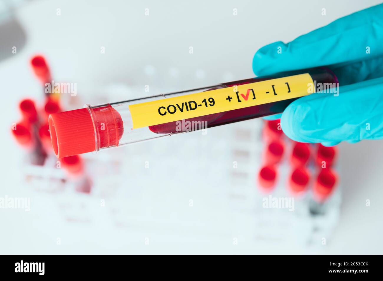 La main de Laboratorian montre un résultat positif pour le tube à essai covid-19 dans le laboratoire du coronavirus. Banque D'Images