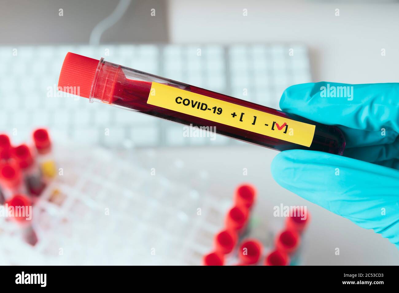 La main de Laboratorian montre un résultat négatif sur le tube à essai covid-19 dans le laboratoire du coronavirus. Banque D'Images