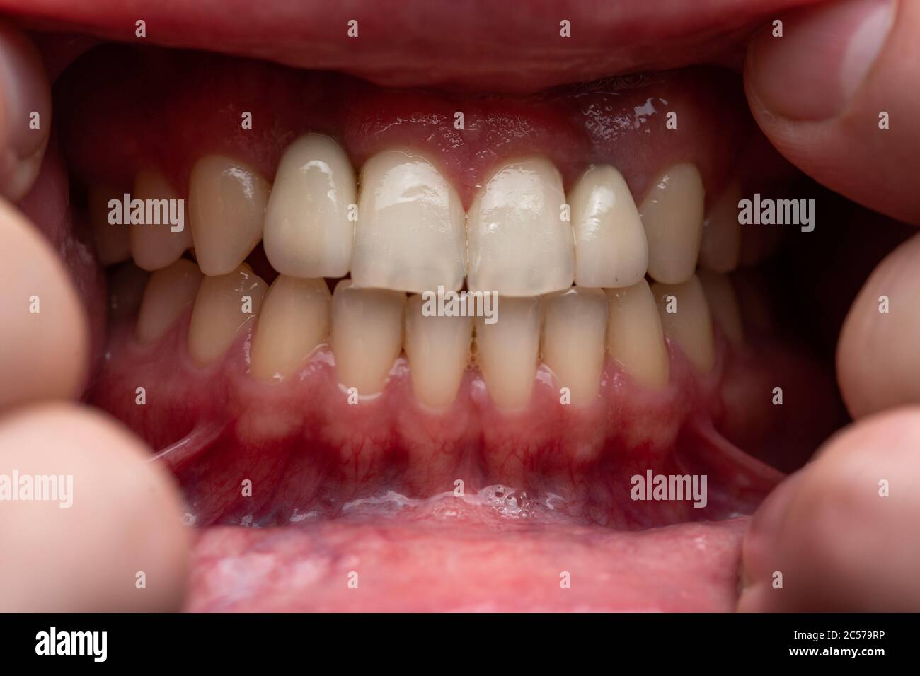 Photo du jeune homme, montrant les dents, gros plan Banque D'Images