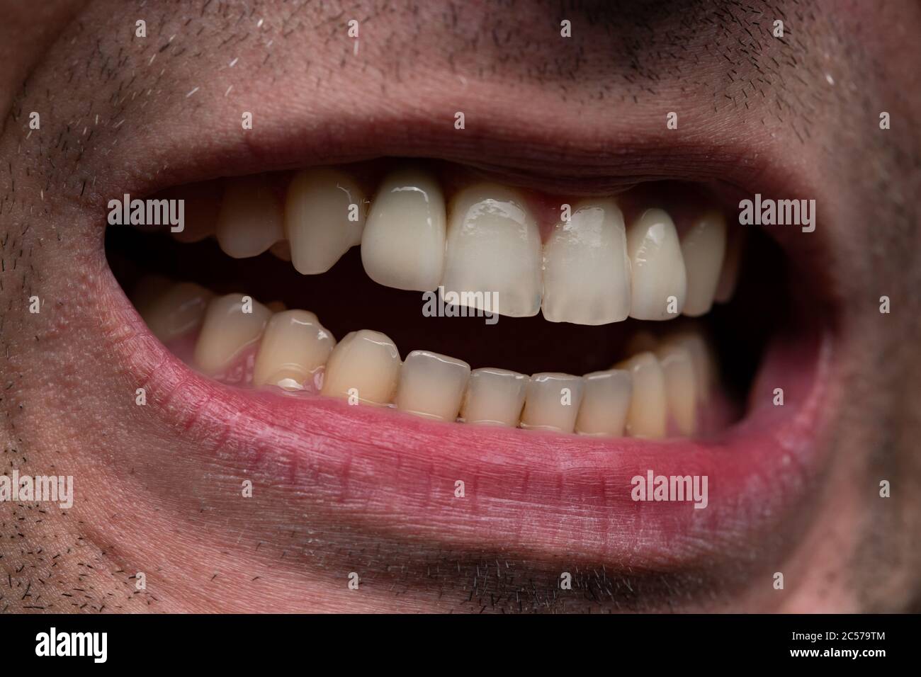 Image d'un jeune homme à bouche ouverte, montrant des dents Banque D'Images