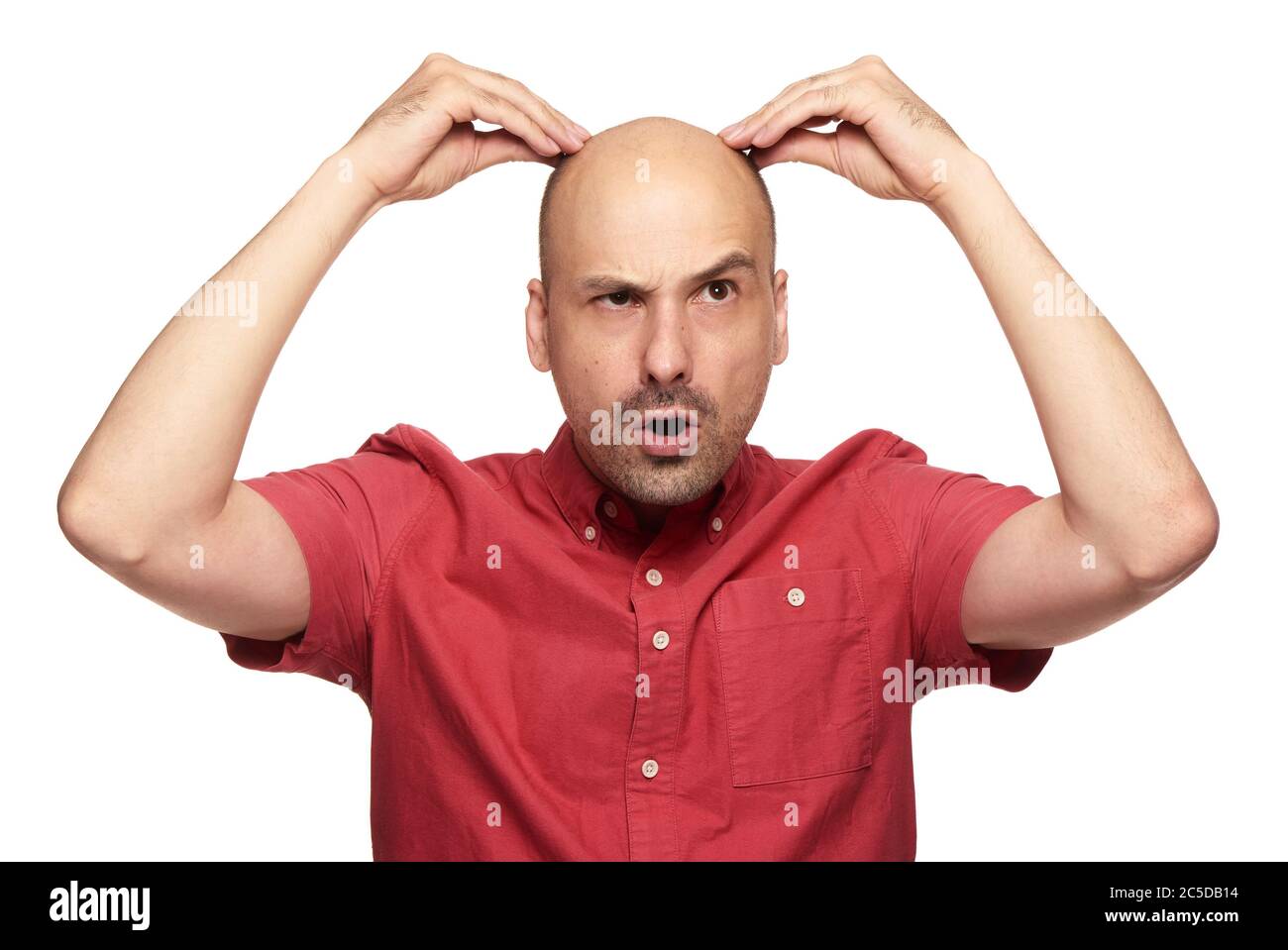 Drôle de chauve gars choqué. Homme perte de cheveux concept. Isolé sur fond blanc de studio Banque D'Images