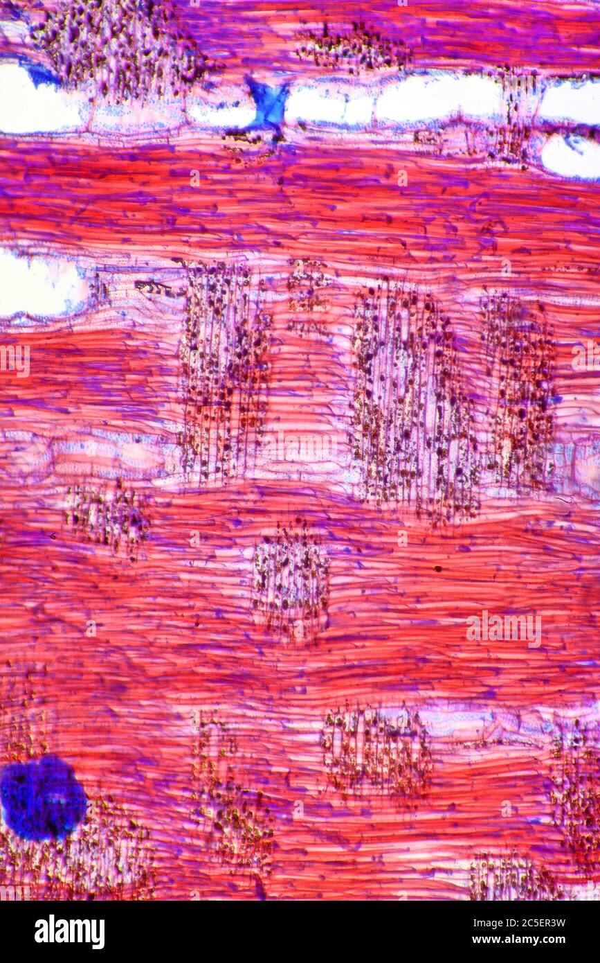 Elm anglais, section de racine, Ulmus procera, photomicrographe à fond clair Banque D'Images