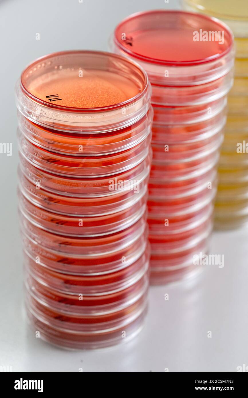 Les boîtes de Petri rouges et jaunes sont empilées dans un laboratoire de  microbiologie sur le fond du laboratoire de bactériologie Photo Stock -  Alamy