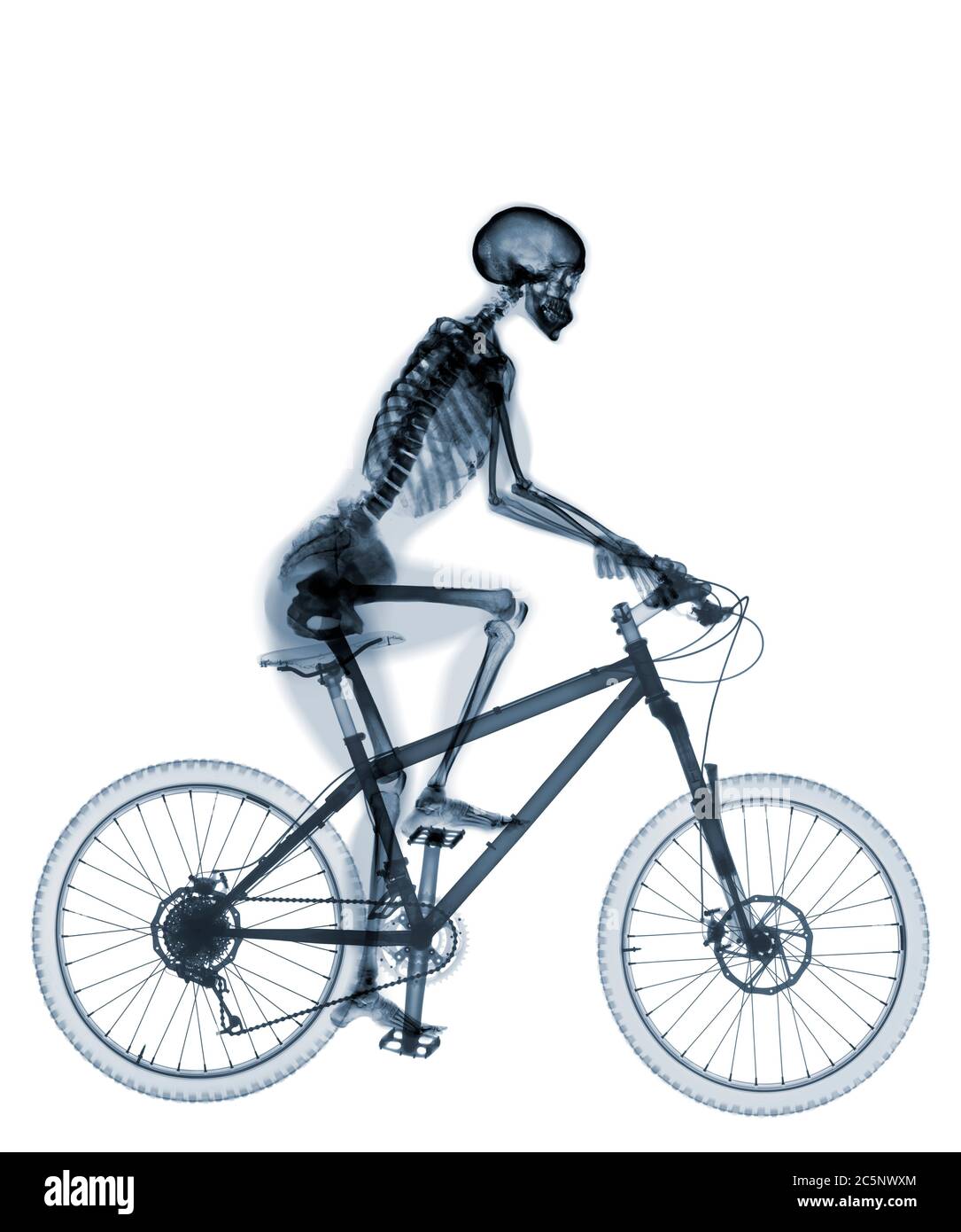 Squelette de vélo de montagne, rayons X. Banque D'Images