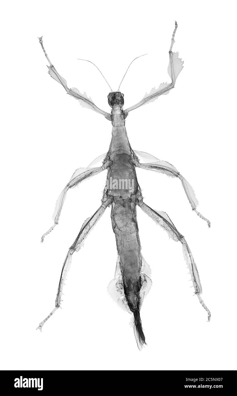 Insecte de bâton (Extatosoma popoi horridus), rayons X. Banque D'Images Insecte de bâton (Extatosoma popoi horridus), rayons X. Banque D'Images