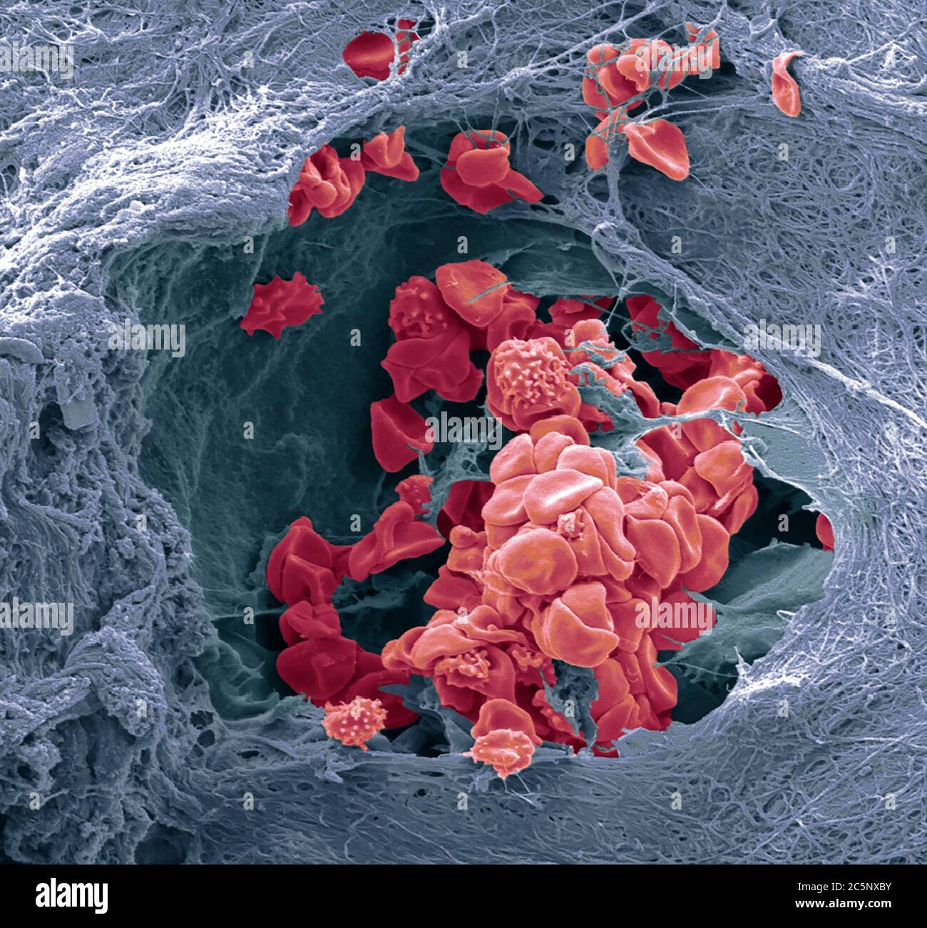 Vaisseau sanguin cutané. Micrographe électronique à balayage coloré (SEM) d'un vaisseau sanguin (artériole) dans le derme de la peau. Dans le vaisseau sanguin se trouvent les globules rouges (érythrocytes, rouges) qui transportent l'oxygène autour du corps. Certaines de ces globules rouges sont crénelées. Le vaisseau sanguin est entouré de tissu conjonctif qui donne à la peau son tonus et son élasticité. Agrandissement : 1000 lorsqu'il est imprimé à 10 centimètres de large. Banque D'Images
