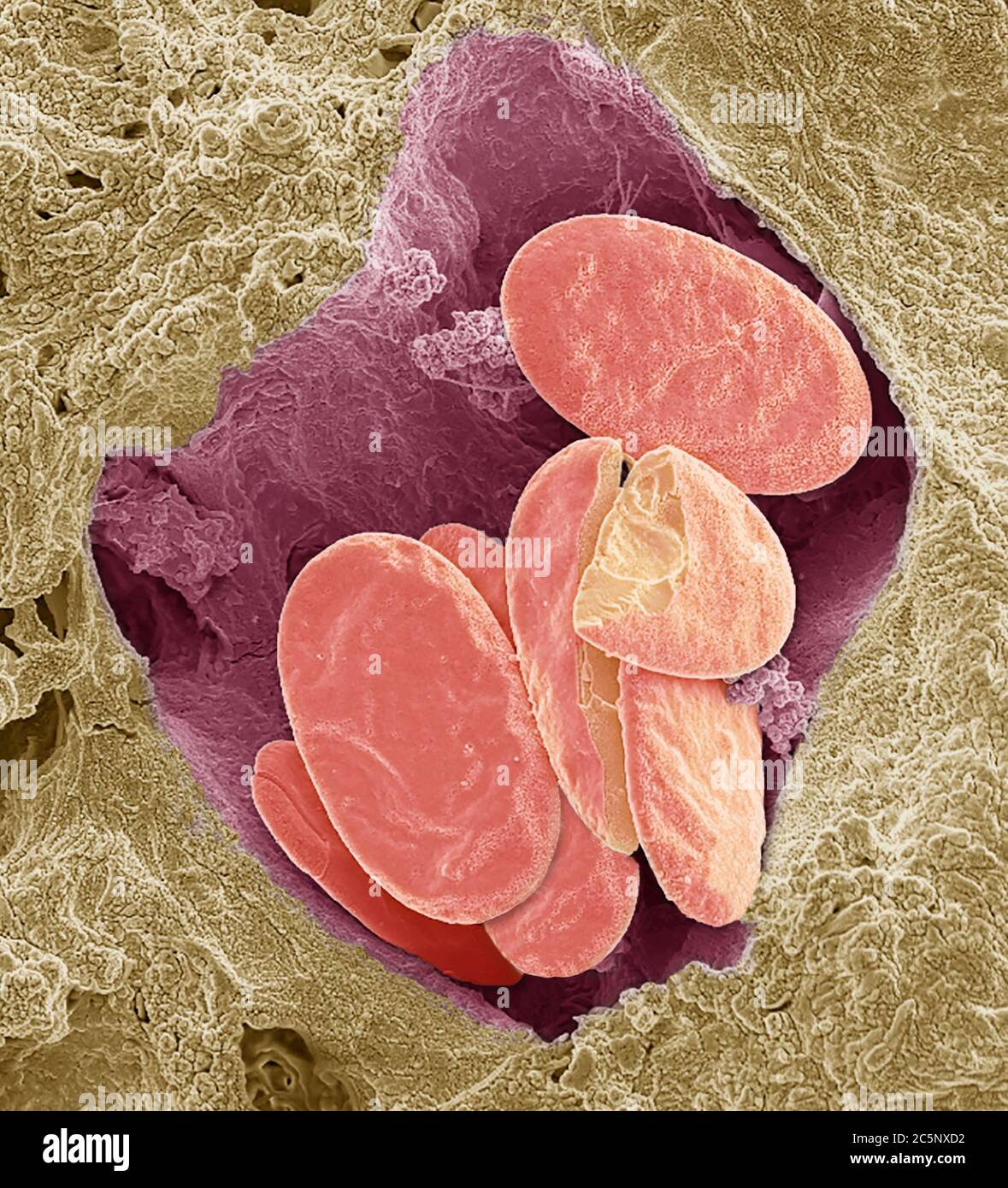 Globules rouges de serpent. Micrographe électronique à balayage coloré (SEM) de globules rouges entiers et fracturés (érythrocytes, rouges) dans un petit vaisseau sanguin d'un serpent. Ces cellules contiennent de l'hémoglobine, un pigment qui leur permet de transporter de l'oxygène autour du corps. Les globules rouges non mammifères (tels que ceux-ci) sont de forme ovale (discoïde) et contiennent un noyau cellulaire. Les globules rouges humains sont en forme de disque et n'ont pas de noyau cellulaire. Agrandissement : x3000 lors de l'impression de 10 centimètres de large. Banque D'Images