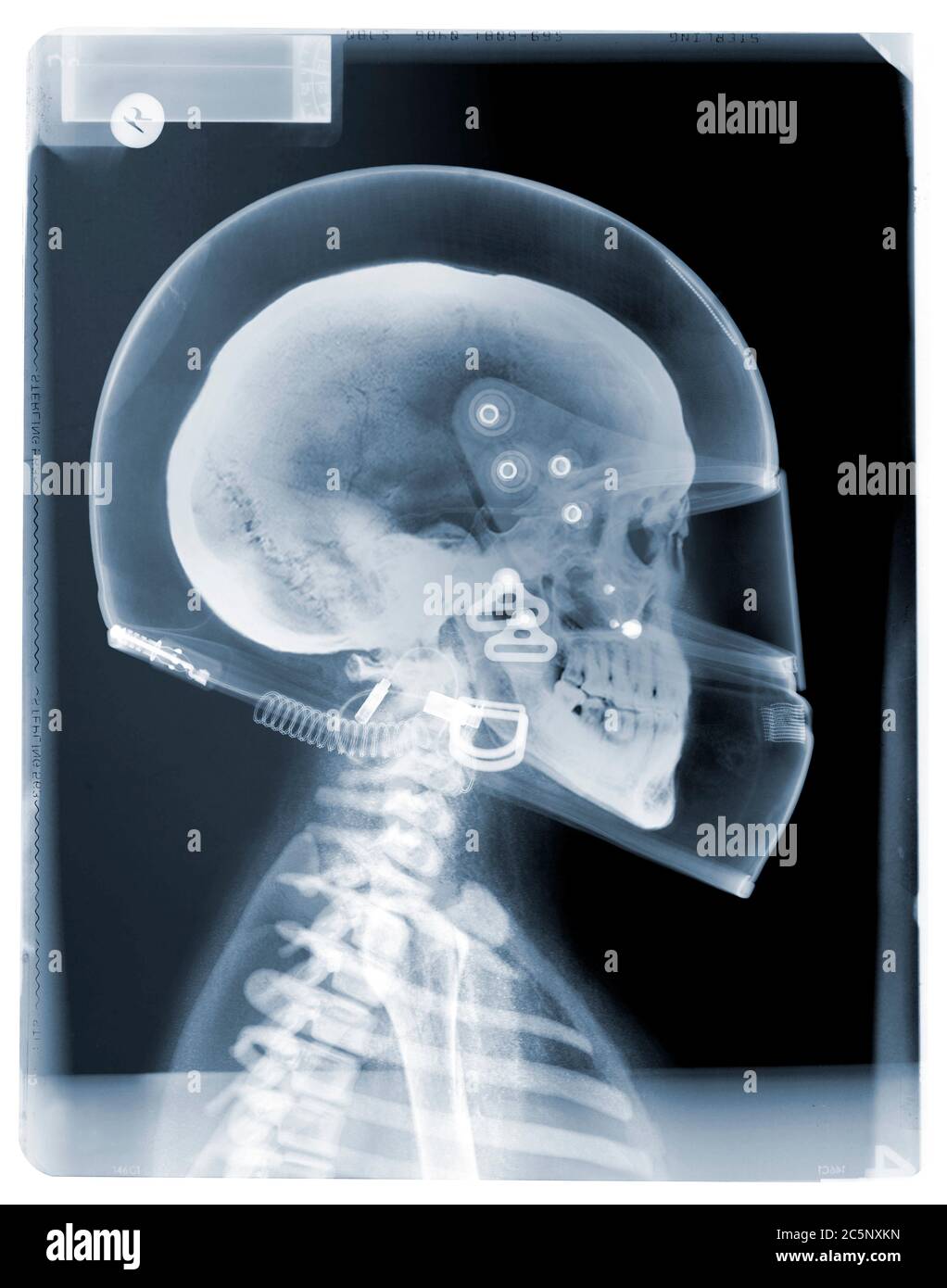 Conducteur avec casque de conduite, rayons X. Banque D'Images