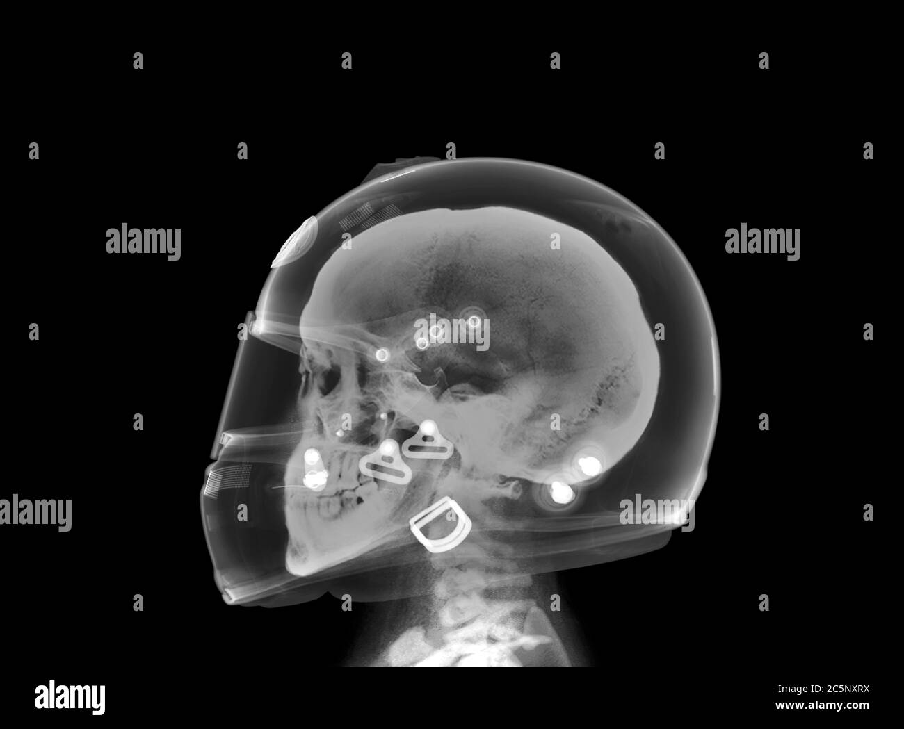 Crâne et casque, rayons X. Banque D'Images