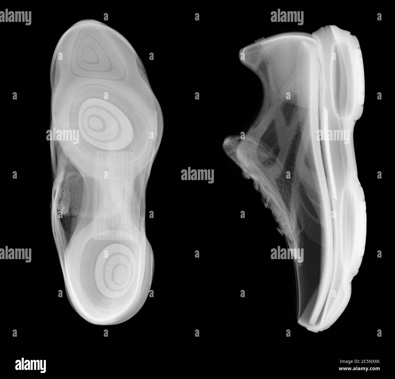 Chaussures de course à pied, rayons X. Banque D'Images