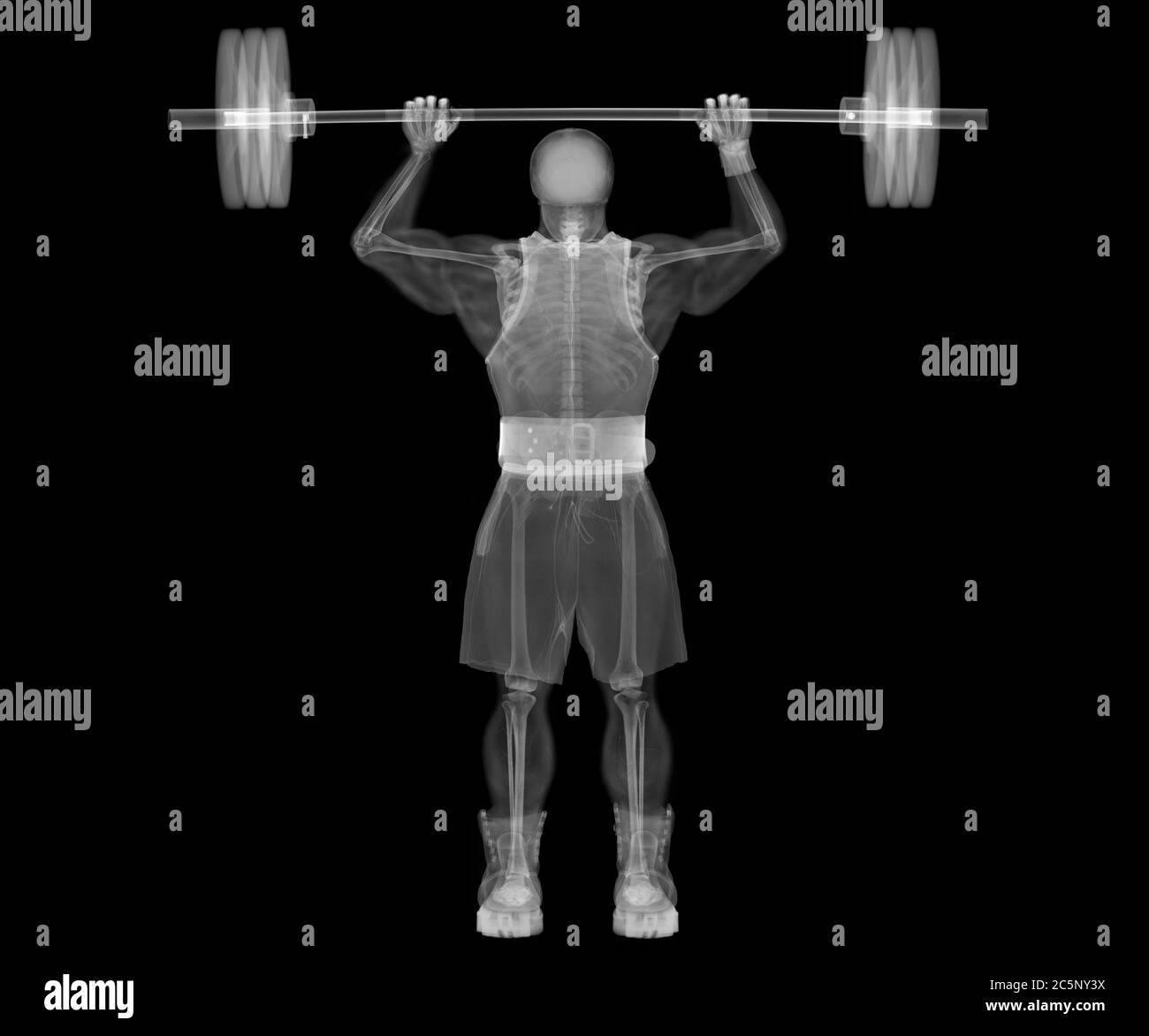 Squelette de musculation, rayons X. Banque D'Images