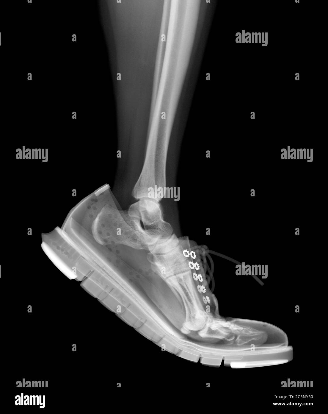 Squelette bas de jambe dans la rigue chaussures marche, rayons X. Banque D'Images