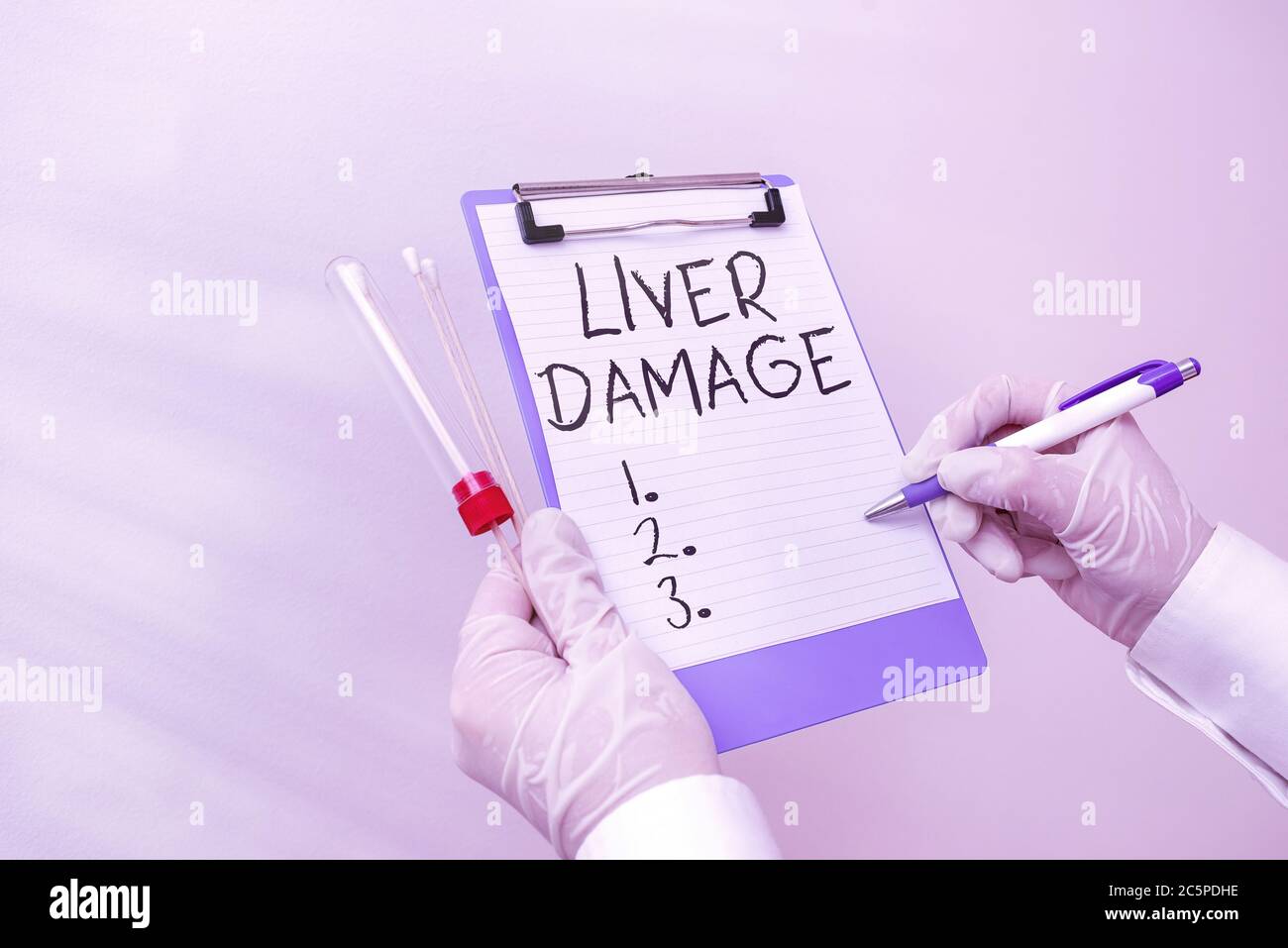 Texte d'écriture endommagé foie. Photo conceptuelle tout trouble de la cirrhose du foie ou de la cicatrisation du foie laboratoire échantillon de sang montré pour moi Banque D'Images
