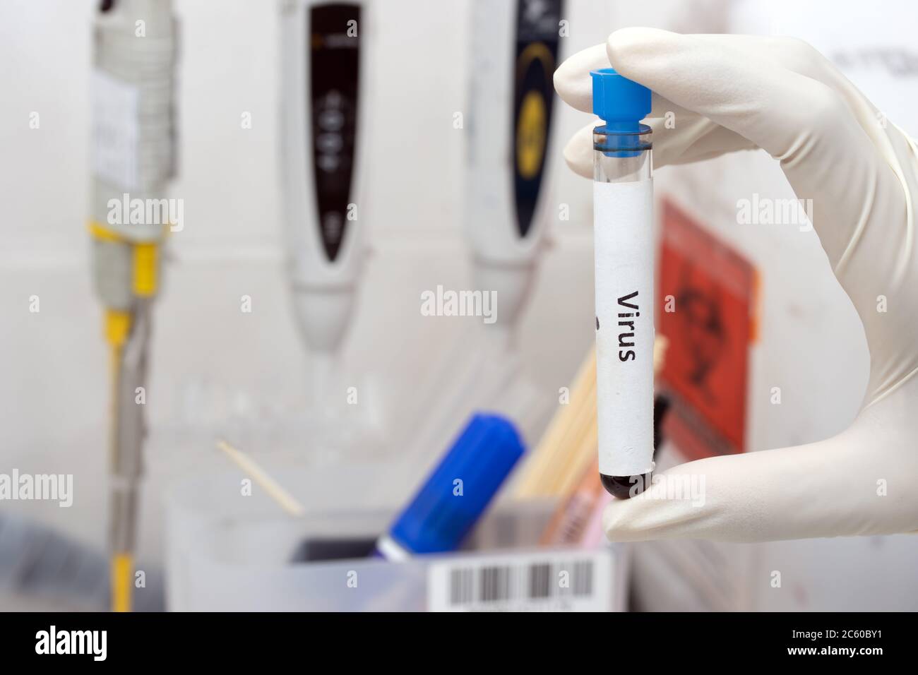 Recherche de virus en laboratoire. Main dans le gant tenant un tube à essai avec l'inscription virus dans un laboratoire. Échantillon de sang. Banque D'Images