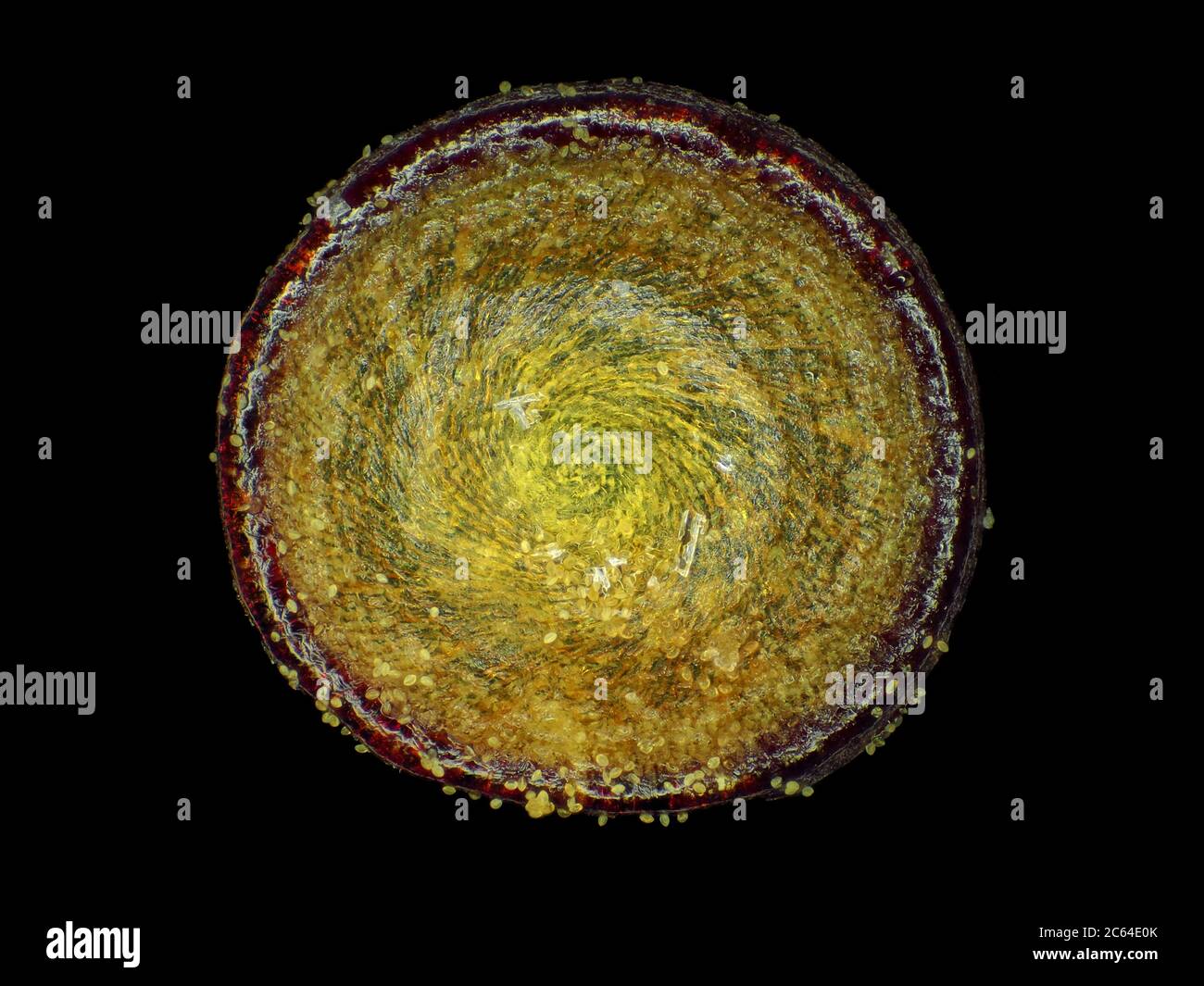 Moss opercule (couvercle de capsule de spores), d'environ 0,9 mm de diamètre, sous le microscope Banque D'Images