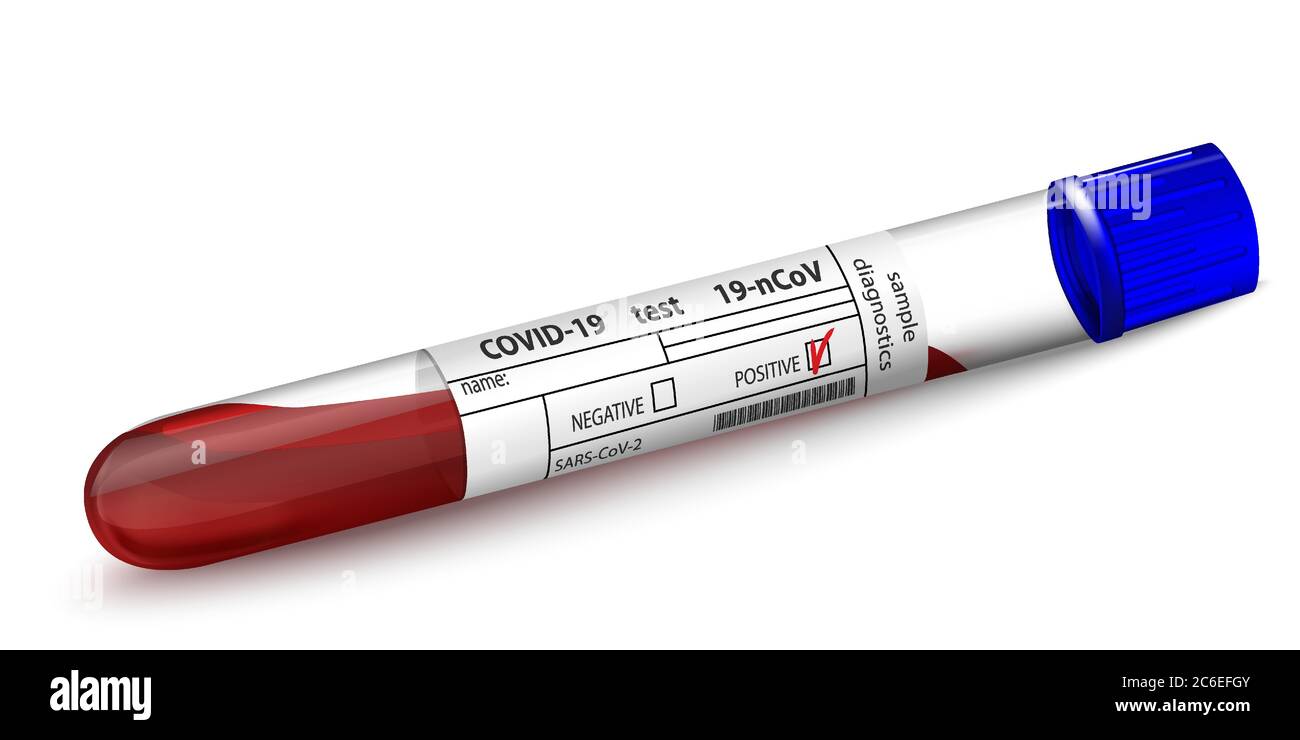 Tube à essai avec échantillon de sang pour le diagnostic du virus Covid 19. Formulaire de résultat positif pour le résultat du test coronavirus 2019-nCoV. Verre 3d réaliste isolé Illustration de Vecteur Tube à essai avec échantillon de sang pour le diagnostic du virus Covid 19. Formulaire de résultat positif pour le résultat du test coronavirus 2019-nCoV. Verre 3d réaliste isolé Illustration de Vecteur