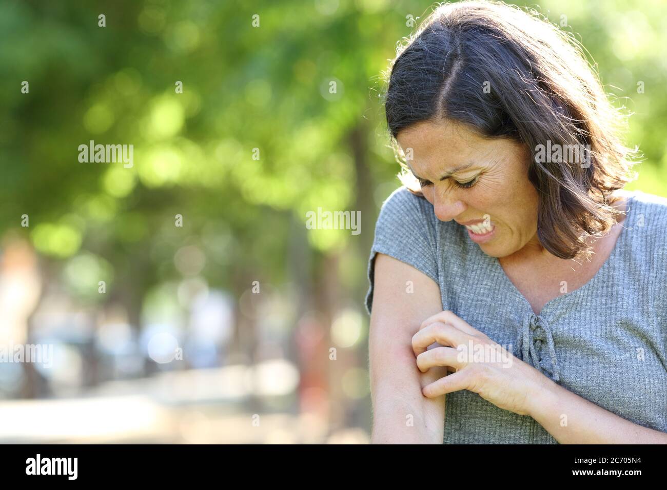 Femme adulte avec la peau qui démange égratignures bras debout dans le parc en été Banque D'Images