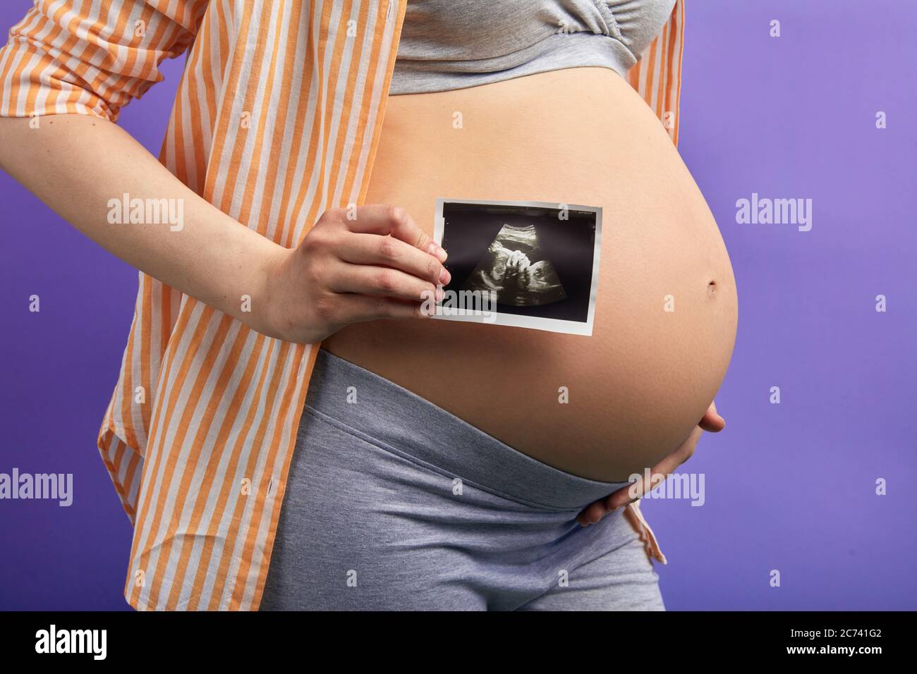 Femme Enceinte Tenant Une Photo De L Echographie D Un Bebe A Naitre Devant Son Ventre Rond Isolee Sur Fond Violet En Gros Plan Photo Stock Alamy