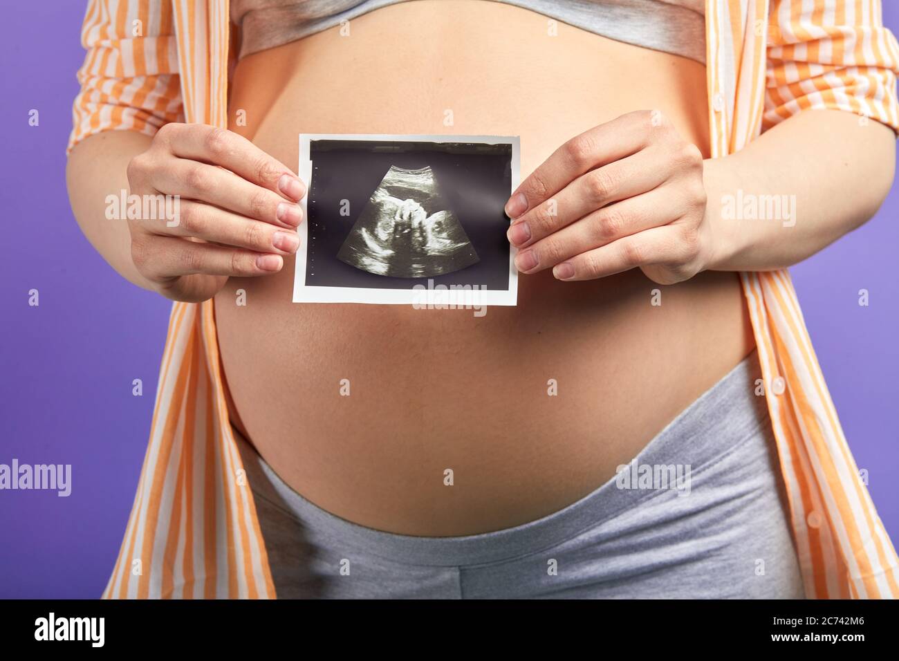 Femme Enceinte Tenant Une Photo De L Echographie D Un Bebe A Naitre Devant Son Ventre Rond Isolee Sur Fond Violet En Gros Plan Photo Stock Alamy