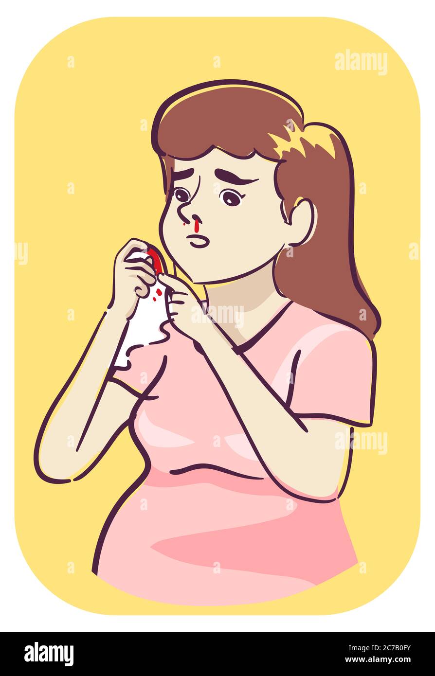 Illustration d'une femme enceinte tenant du tissu ou un mouchoir à l'aide d'un sang de son nez, symptôme de saignement du nez Banque D'Images