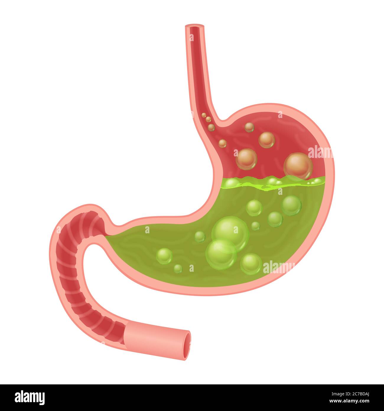 Illustration médicale réaliste de nausées isolées de l'estomac. Liquide vert à l'intérieur de l'estomac Illustration de Vecteur