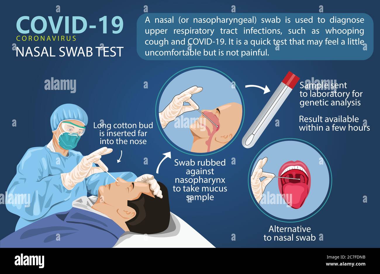 Un homme est submergé pour un test Covid-19. Pour accélérer le test du virus corona, un nouveau type de prélèvement nasal. Info graphiques illustration vectorielle créative. Illustration de Vecteur