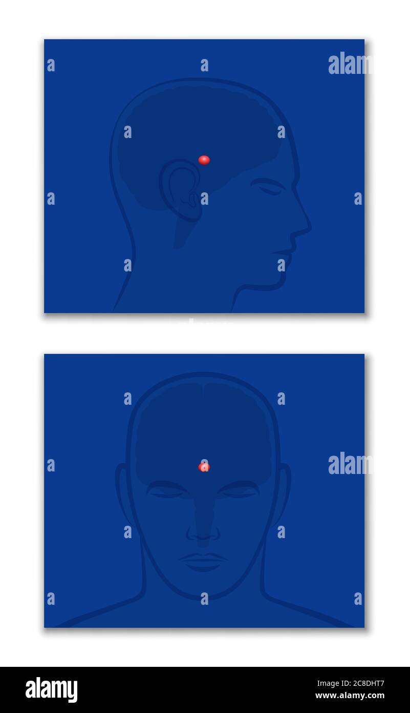 Glande pinéale, épiphyse cerebri, troisième œil. Vue de profil et vue frontale avec position dans le cerveau humain - illustration sur fond blanc. Banque D'Images