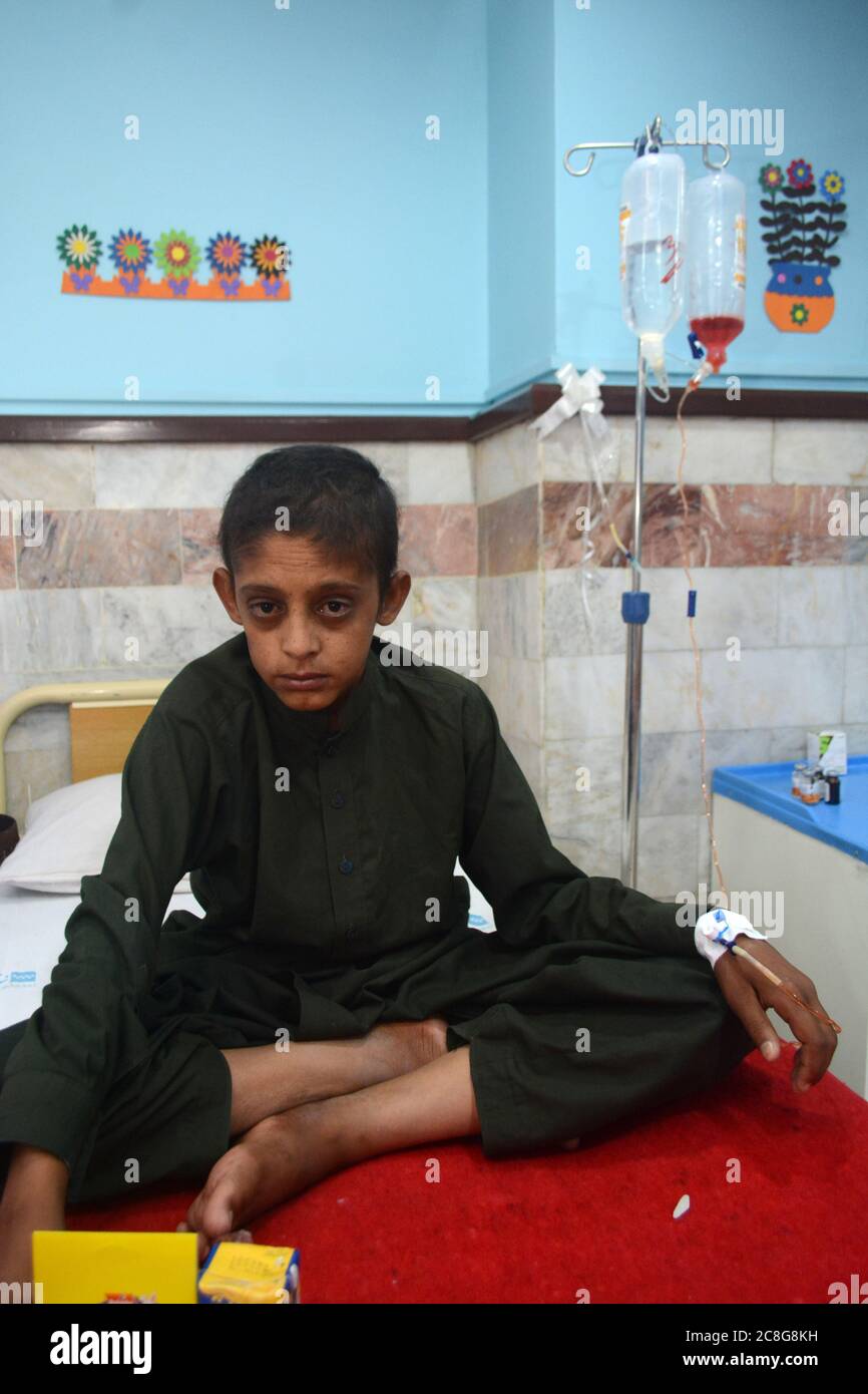 QUETTA, BALOUTCHISTAN, PAKISTAN. 24 au 2020 juillet : un enfant en cours de chimiothérapie participant à une activité de décoration de paroisse avec des enfants patients en on Banque D'Images