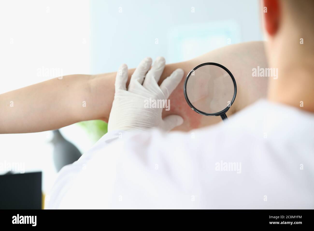 Le médecin examine à travers la loupe réaction allergique sur la main de l'homme. Banque D'Images
