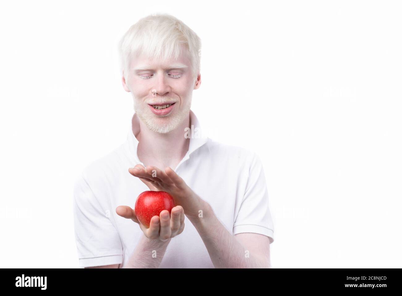 Albinisme albino homme peau blanche cheveux studio habillé t-shirt isolé fond blanc. Anomalies. Aspect inhabituel. Peau anormale belles personnes avec aspect spécial. Mangez de la pomme rouge Banque D'Images