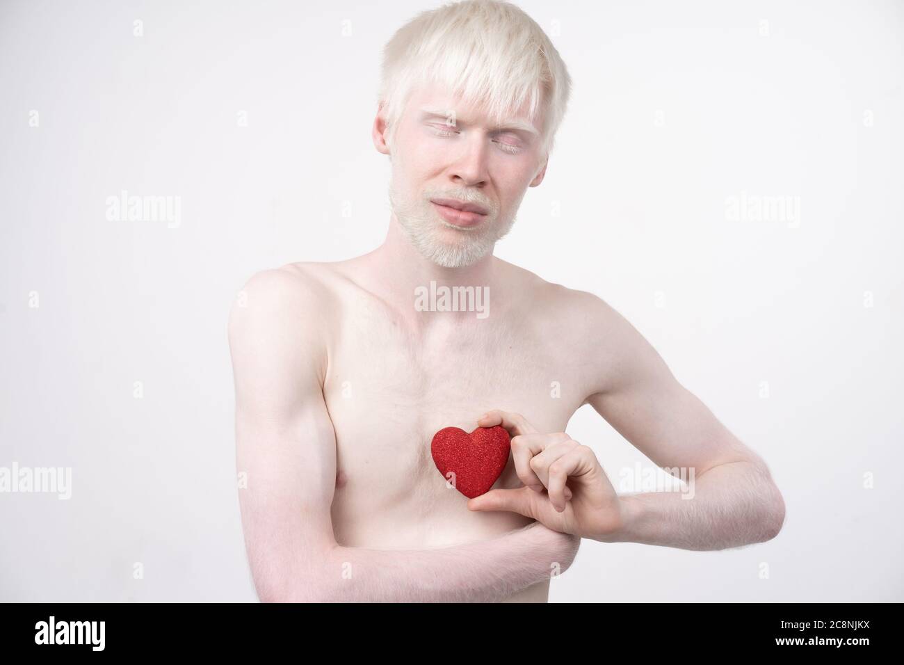 albinisme albinos homme en studio vêtu t-shirt isolé sur fond blanc. déviations anormales. aspect inhabituel. anomalie de la peau Banque D'Images