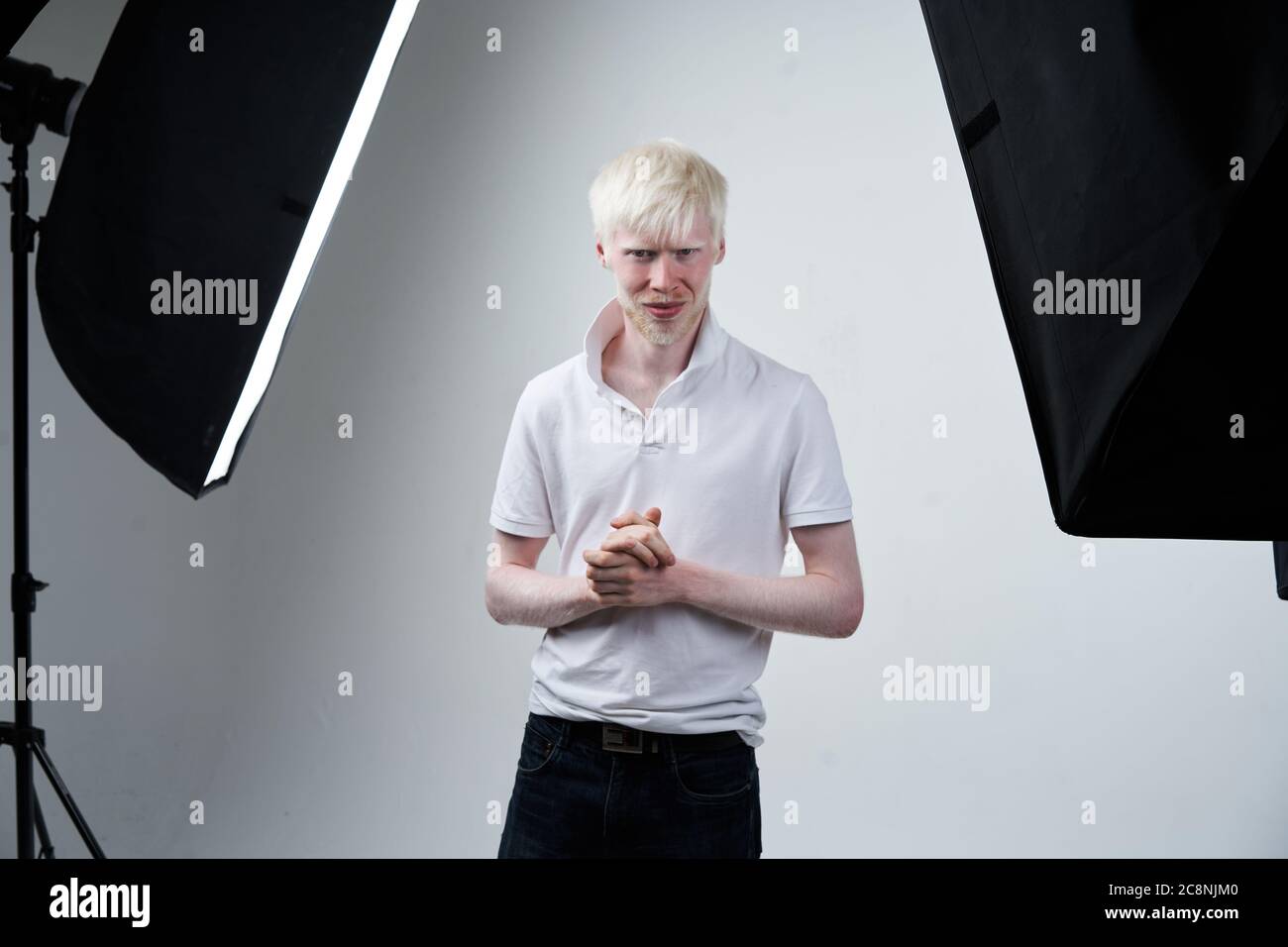 Albinisme sérieux albino homme blanc peau cheveux studio habillé t-shirt debout flash lumière. Écarts anormaux. Peau anormale belles personnes avec l'aspect spécial. Banque D'Images
