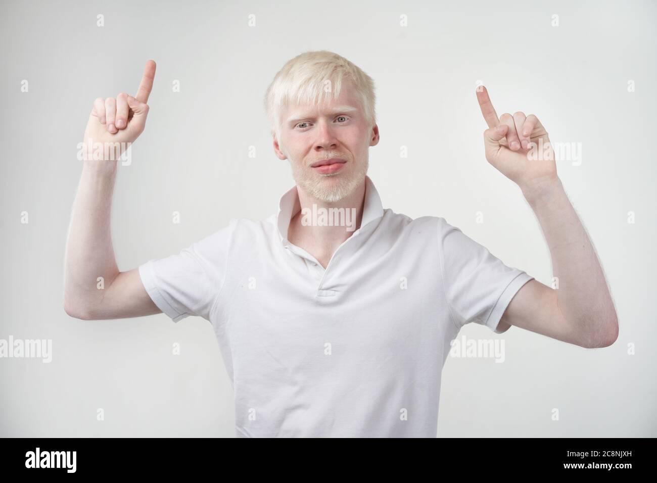 Albinisme albino homme peau blanche cheveux studio habillé t-shirt isolé fond blanc anomalies aspect anormal anomalie belles personnes montre deux doigts vers le haut. Banque D'Images