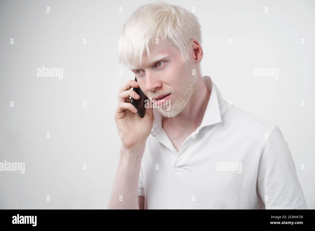 Albinisme albino homme peau blanche cheveux studio habillé t-shirt isolé fond blanc anomalies aspect anormal anomalie belles personnes parlant au téléphone. Banque D'Images