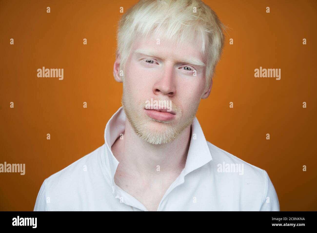 Albinisme triste albino homme blanc peau cheveux studio habillé t-shirt isolé fond jaune. Écarts anormaux. Apparence inhabituelle. Peau anormale belles personnes avec l'aspect spécial. Banque D'Images