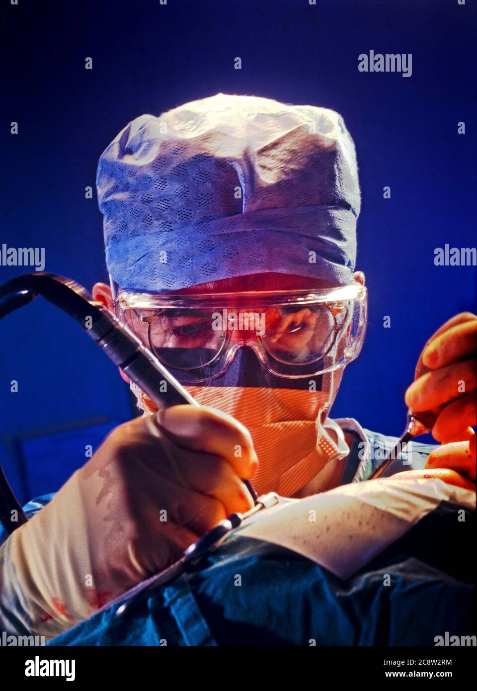 Chirurgie d'implant cochléaire Banque D'Images