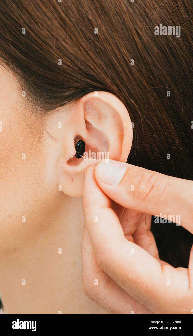 Prothèse auditive intra-auriculaire gros plan sur l'oreille féminine. La solution auditive, audiologiste, insertion d'une prothèse auditive, gros plan. Banque D'Images