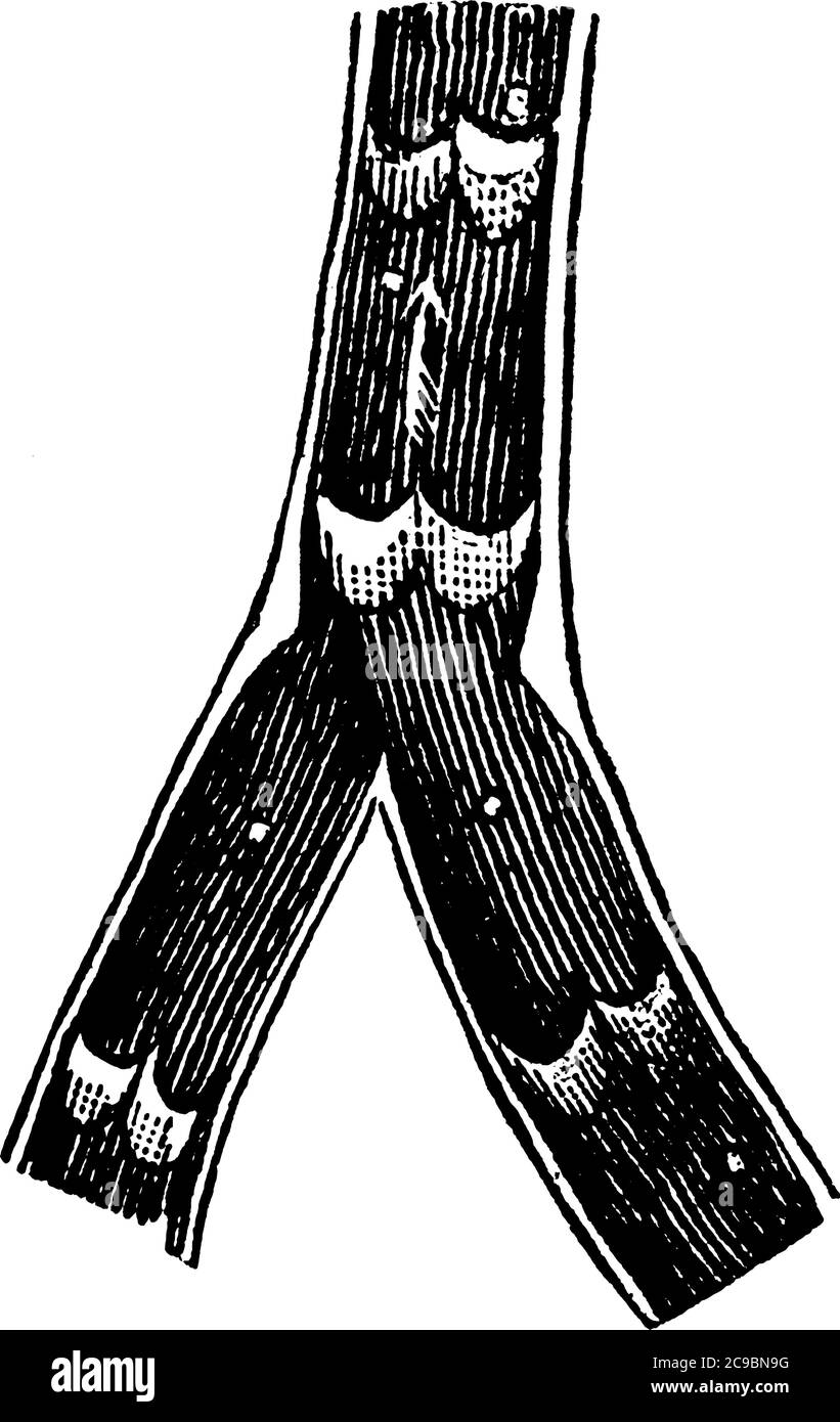 Une représentation typique de la veine humaine, un vaisseau sanguin qui transporte le sang vers le cœur, dessin de ligne vintage ou illustration de gravure. Illustration de Vecteur