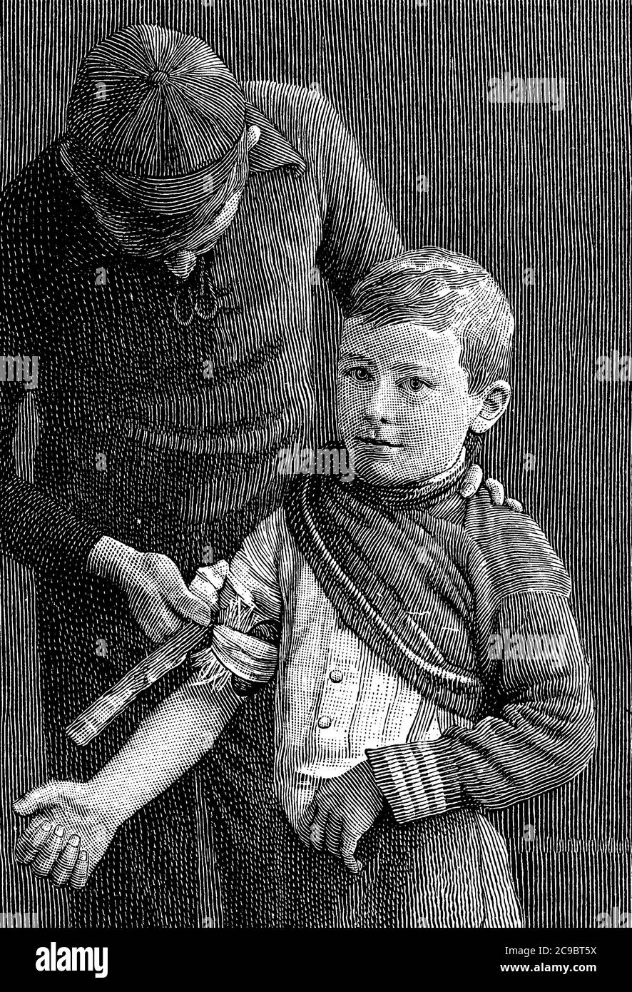 Adapté pour arrêter le saignement d'une artère dans le bras et consiste en une pomme de terre maintenue en place au-dessus de l'artère par un mouchoir de poche utilisé comme une bande. A Illustration de Vecteur