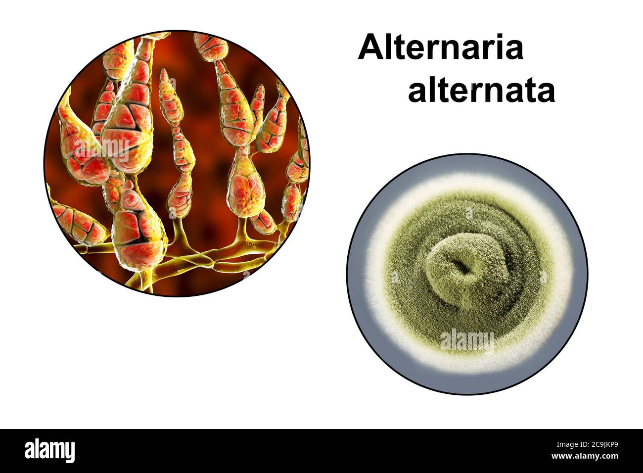 Champignon allergène filamenteux Alternaria alternata, illustration informatique de la morphologie fongique et photographie des colonies fongiques sur Sabouraud Dextrose Banque D'Images