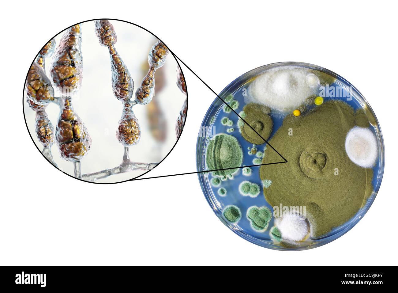 Champignon allergène filamenteux Alternaria alternata, illustration informatique de la morphologie fongique et photographie des colonies fongiques sur Sabouraud Dextrose Banque D'Images