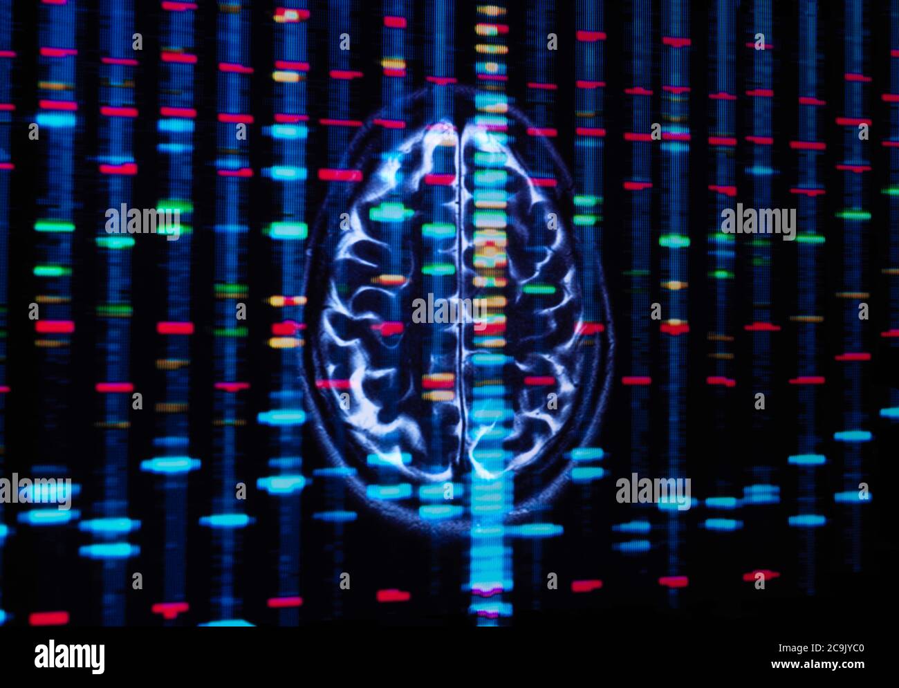 Recherche génétique, image conceptuelle. Profil de l'ADN (acide désoxyribonucléique) et balayage du cerveau Banque D'Images