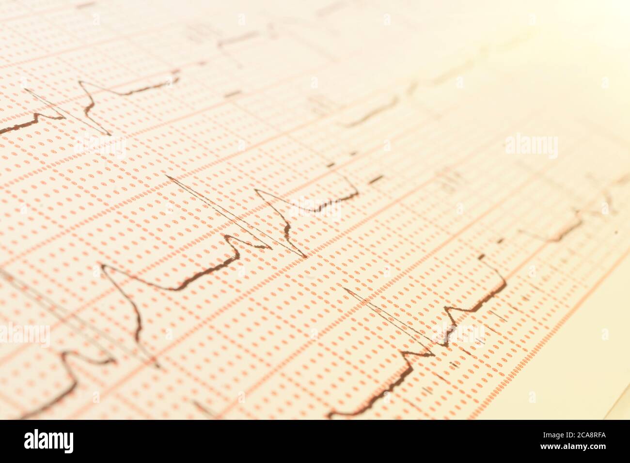 Texture des ondes pulsées. Cardiogramme sur une feuille de papier gros plan. Banque D'Images