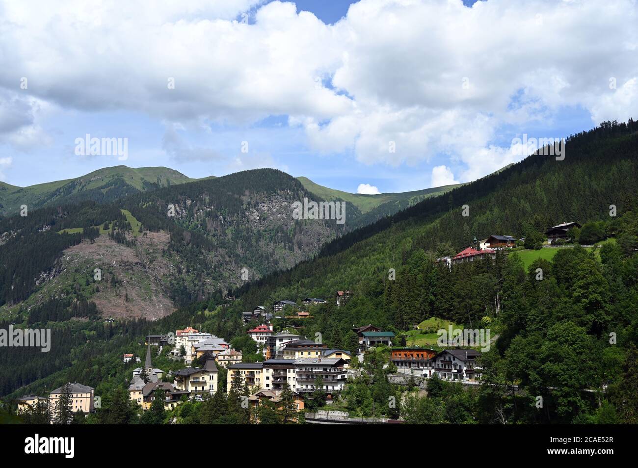 Paysage de Bad Gastein en été Autriche Banque D'Images