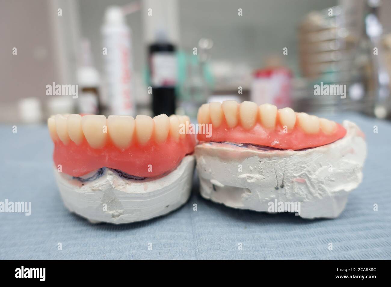 prothèses dentaires amovibles complètes sur les modèles de gypse dans la fabrication processus Banque D'Images