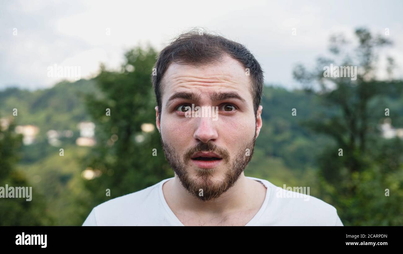 Jeune blanc-peau choqué visage beau homme dans la nature Banque D'Images