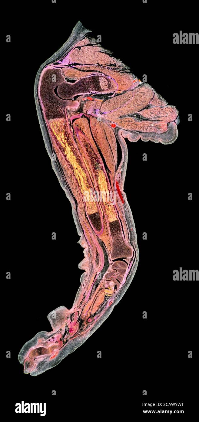 Section de la jambe fœtale du chat, LS. Montrant la structure générale, photomicrographe à fond noir Banque D'Images