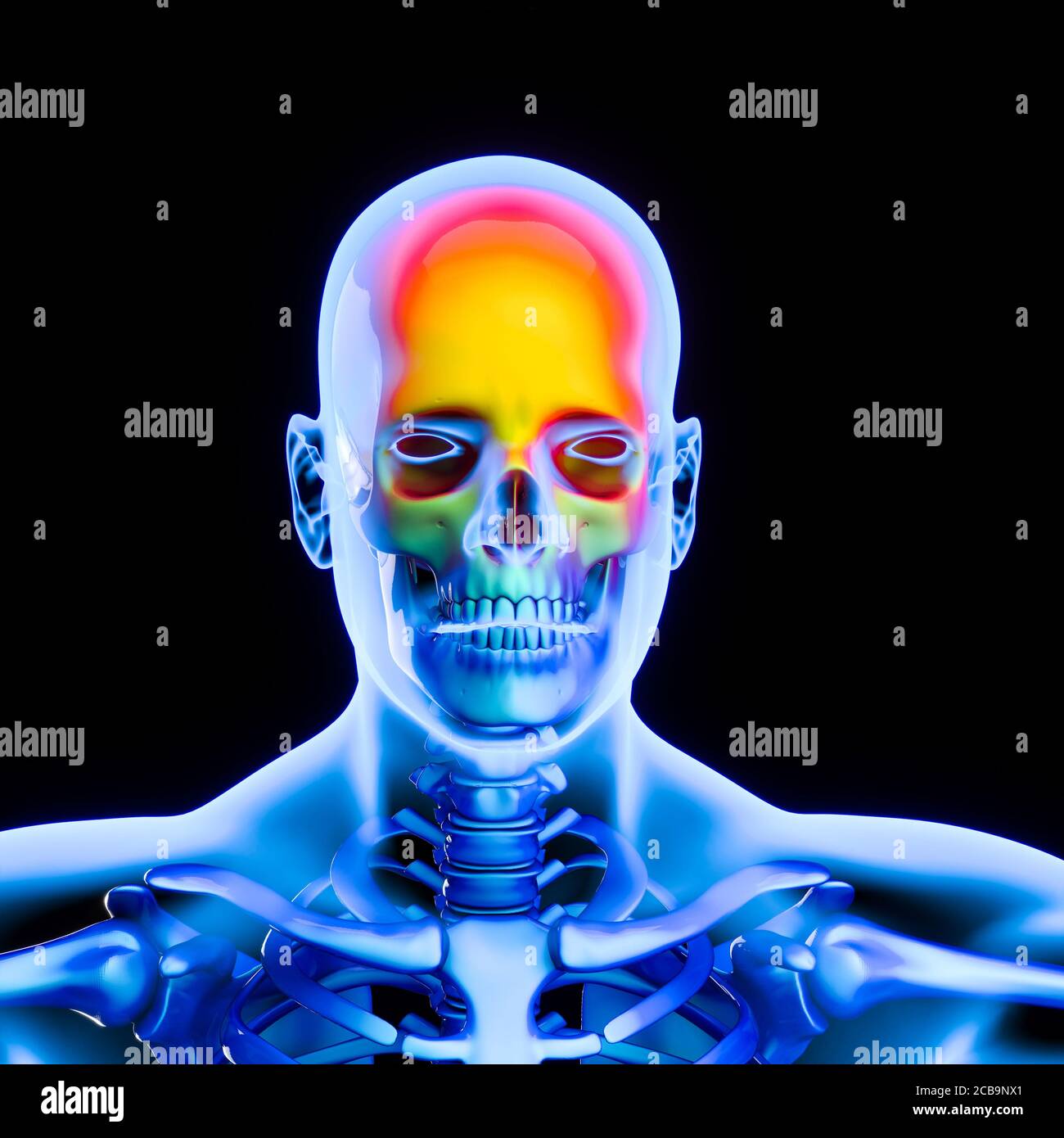 concept de mal de tête. image de rendu 3d. Banque D'Images