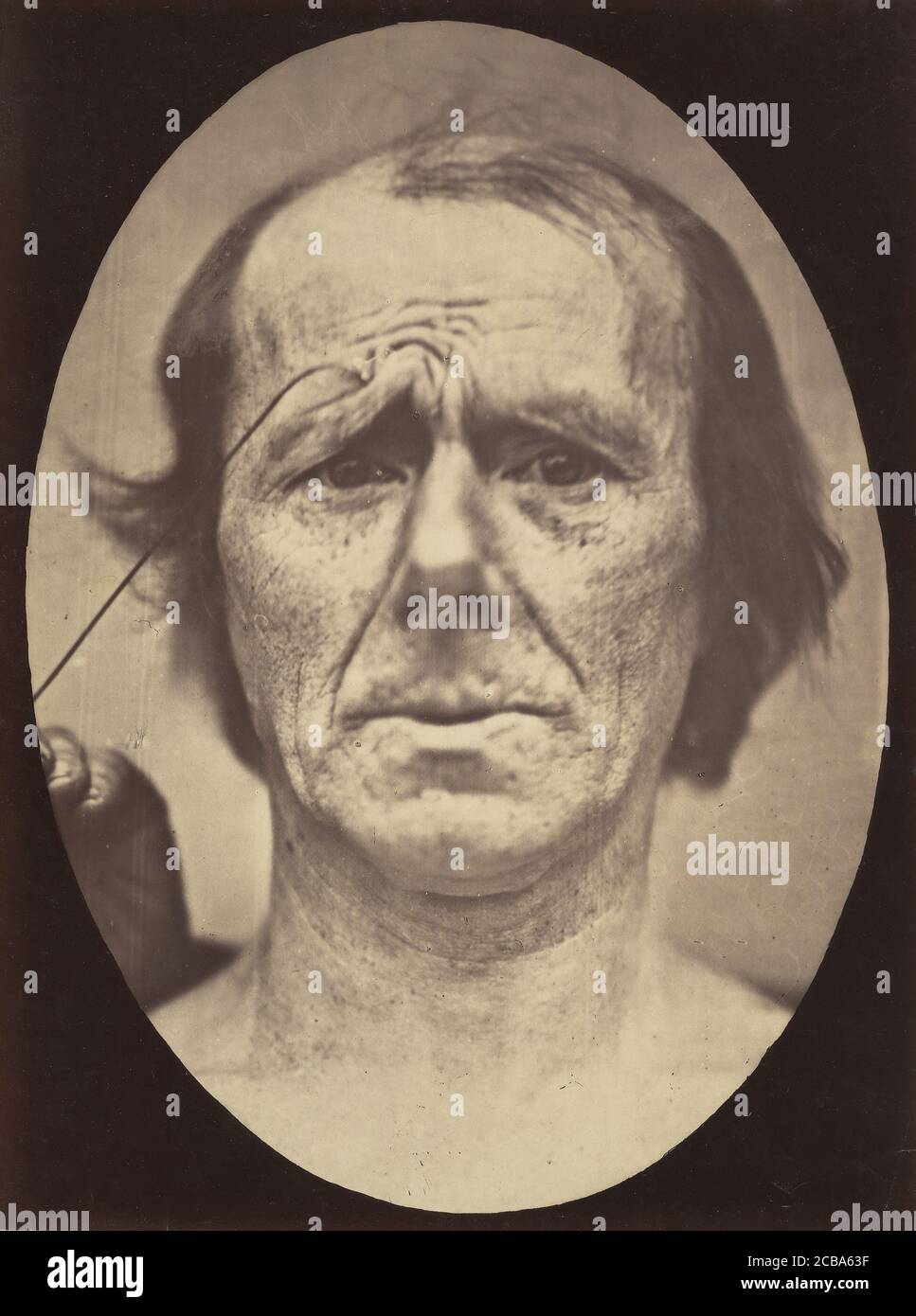Figure 19 : souffrance , 1854-56, imprimé en 1862. Banque D'Images